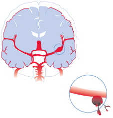 Hk Strickland, medical illustration